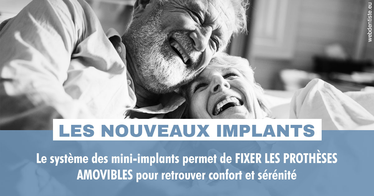 https://dr-do-thi-thuy-thao.chirurgiens-dentistes.fr/Les nouveaux implants 2