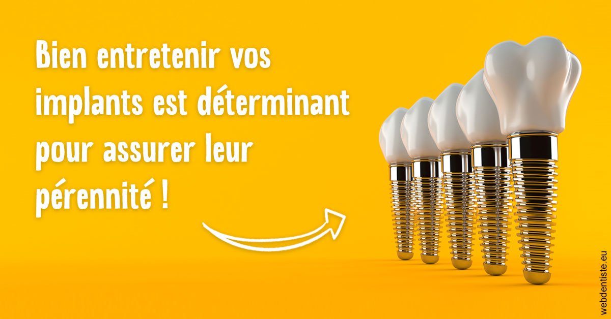 https://dr-do-thi-thuy-thao.chirurgiens-dentistes.fr/Entretien implants 2