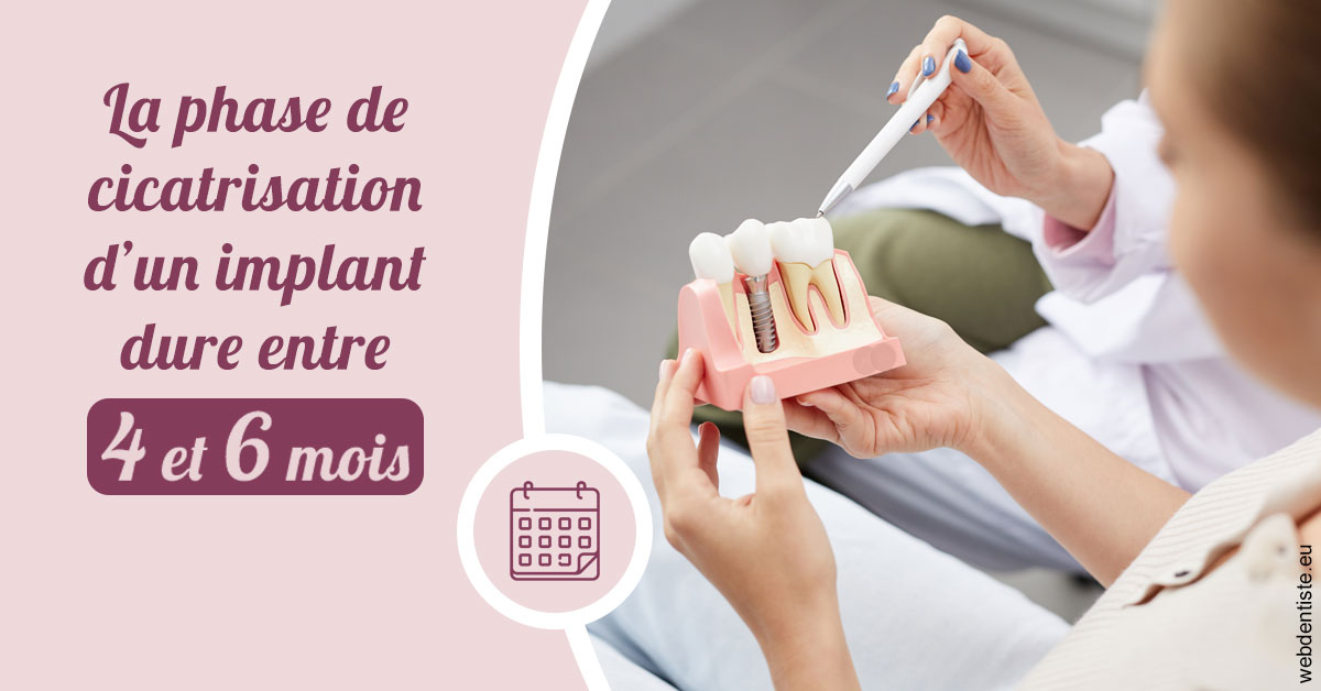 https://dr-do-thi-thuy-thao.chirurgiens-dentistes.fr/Cicatrisation implant 2