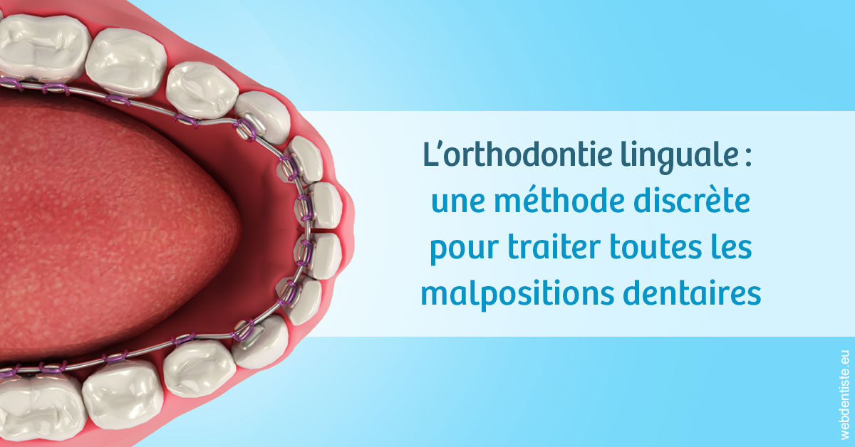 https://dr-do-thi-thuy-thao.chirurgiens-dentistes.fr/L'orthodontie linguale 1