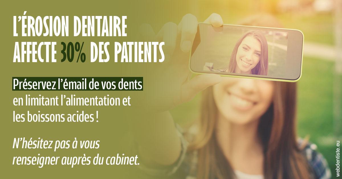 https://dr-do-thi-thuy-thao.chirurgiens-dentistes.fr/L'érosion dentaire 1