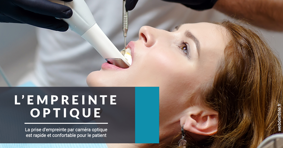 https://dr-do-thi-thuy-thao.chirurgiens-dentistes.fr/L'empreinte Optique 1