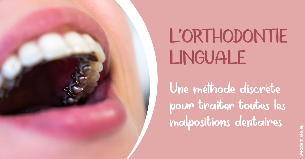 https://dr-do-thi-thuy-thao.chirurgiens-dentistes.fr/L'orthodontie linguale 2