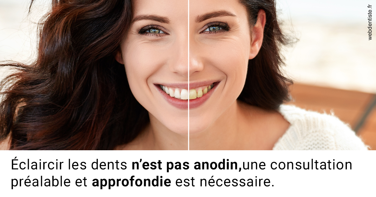 https://dr-do-thi-thuy-thao.chirurgiens-dentistes.fr/Le blanchiment 2