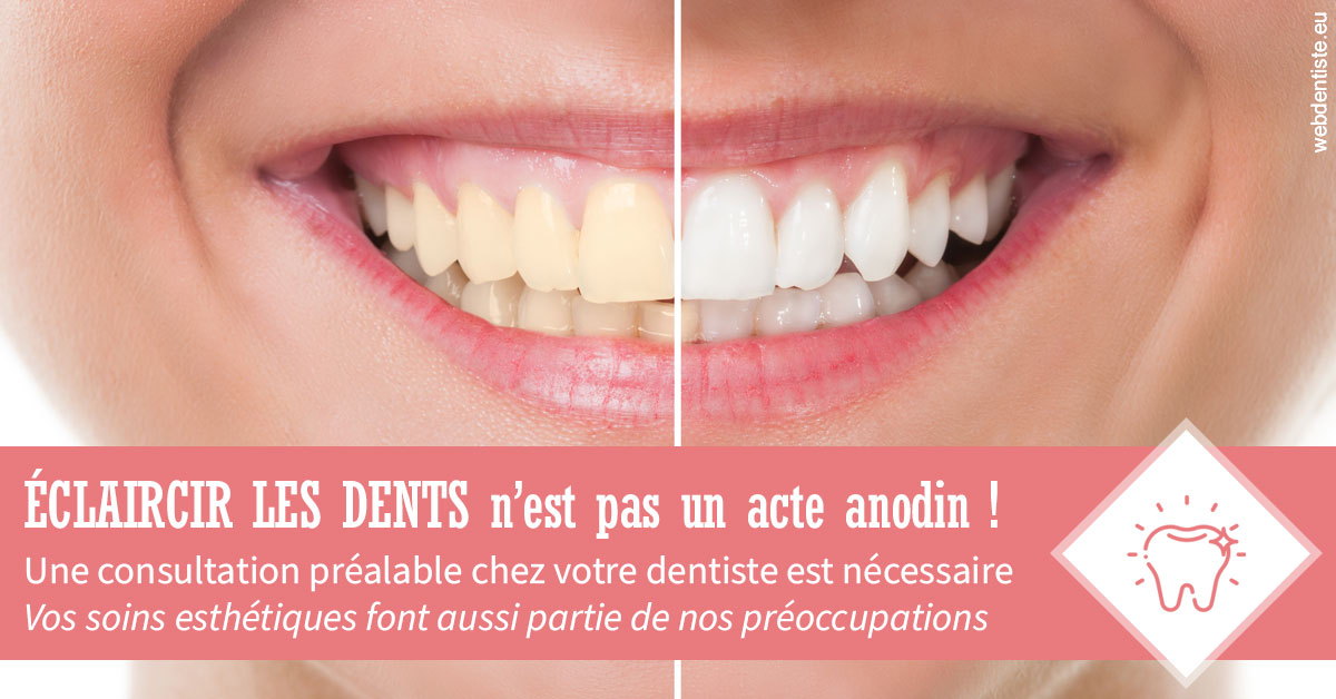 https://dr-do-thi-thuy-thao.chirurgiens-dentistes.fr/Eclaircir les dents 1