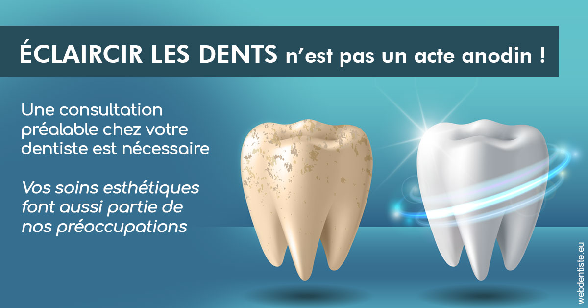 https://dr-do-thi-thuy-thao.chirurgiens-dentistes.fr/Eclaircir les dents 2