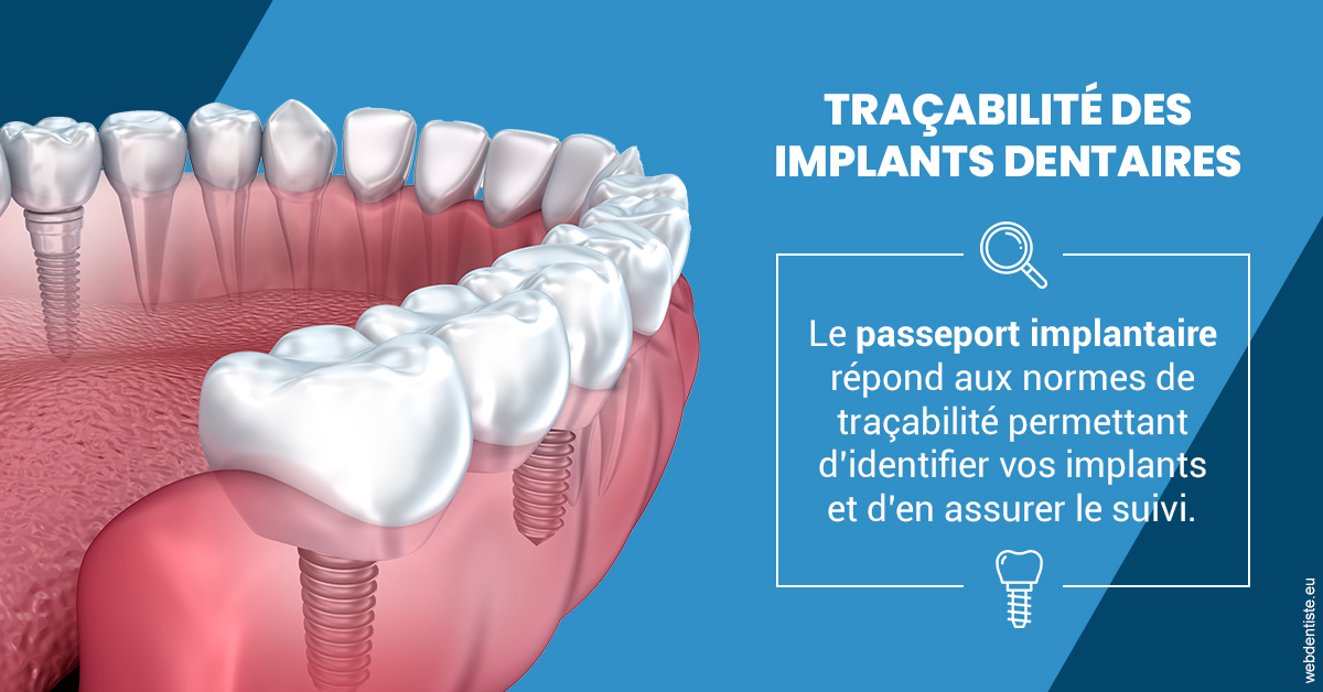 https://dr-do-thi-thuy-thao.chirurgiens-dentistes.fr/T2 2023 - Traçabilité des implants 1