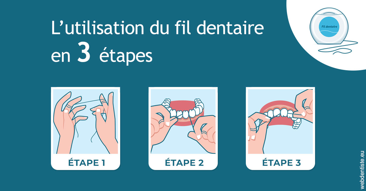 https://dr-do-thi-thuy-thao.chirurgiens-dentistes.fr/Fil dentaire 1