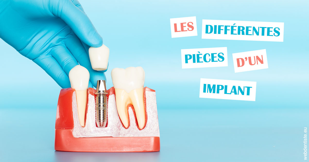 https://dr-do-thi-thuy-thao.chirurgiens-dentistes.fr/Les différentes pièces d’un implant 2