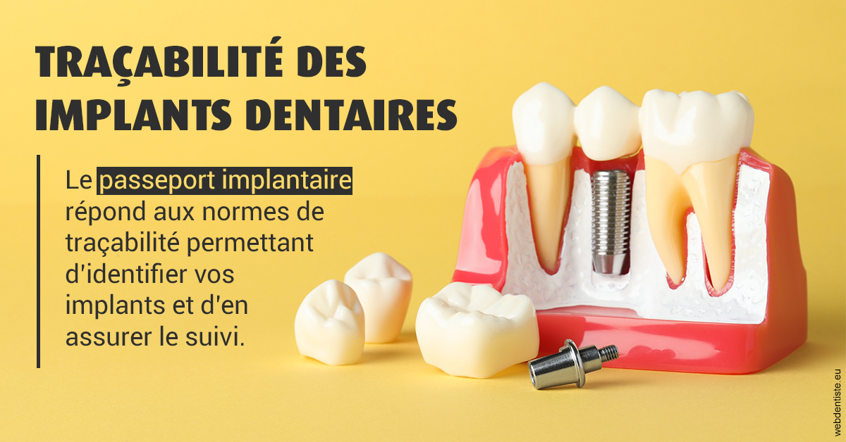 https://dr-do-thi-thuy-thao.chirurgiens-dentistes.fr/T2 2023 - Traçabilité des implants 2
