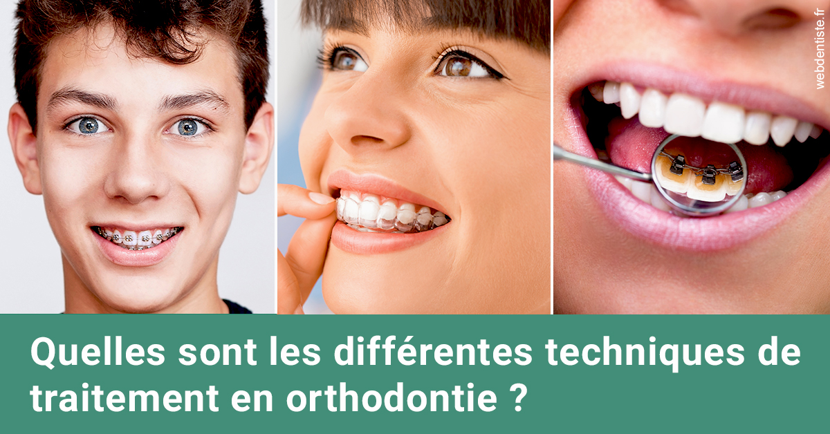 https://dr-do-thi-thuy-thao.chirurgiens-dentistes.fr/Les différentes techniques de traitement 2