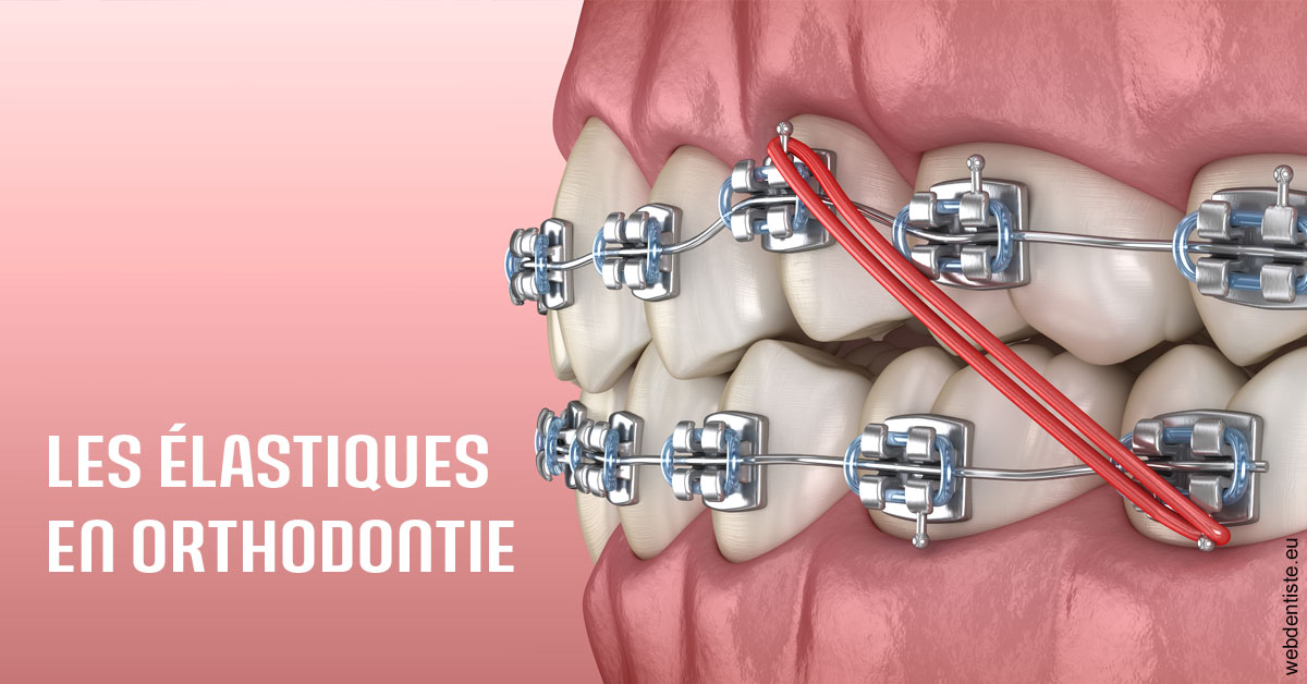 https://dr-do-thi-thuy-thao.chirurgiens-dentistes.fr/Elastiques orthodontie 2
