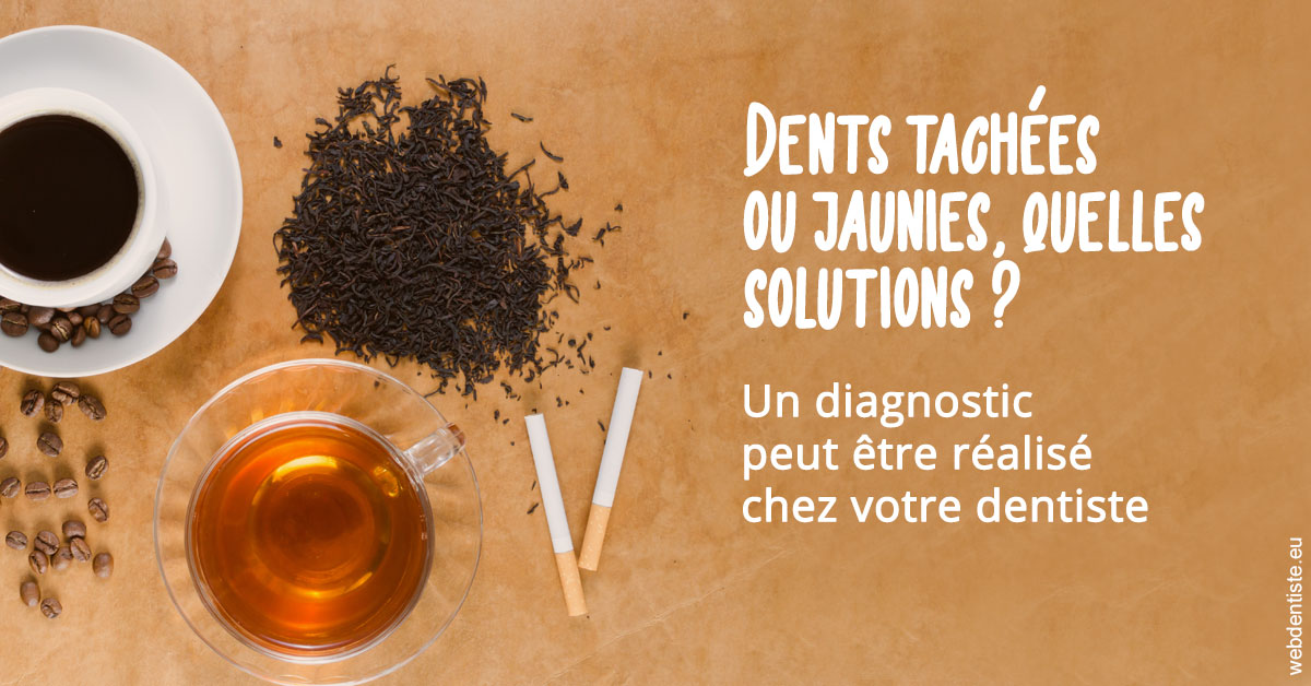 https://dr-do-thi-thuy-thao.chirurgiens-dentistes.fr/Dents tachées 2
