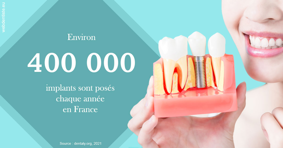 https://dr-do-thi-thuy-thao.chirurgiens-dentistes.fr/Pose d'implants en France 2