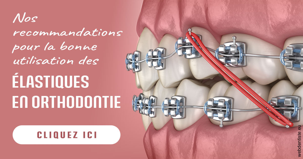 https://dr-do-thi-thuy-thao.chirurgiens-dentistes.fr/Elastiques orthodontie 2